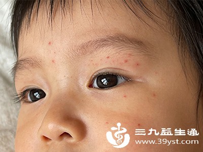 保持皮肤清洁 保持皮肤清洁