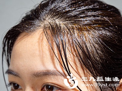 皮脂腺分泌亢进