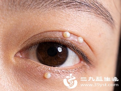 脂肪粒自动脱落要多久 情况不同时间异 别急着动手处理