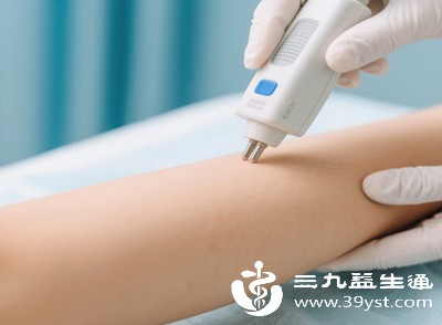 电针脱毛是通过细小的金属针将电流导入毛囊，直接破坏毛囊和毛乳头，从根源上阻止毛发再生，适合脚毛粗硬、顽固，且激光脱毛效果不佳的人群