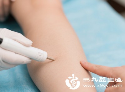 激光脱毛优点是效率高、痛感适中、适用范围广，缺点是对肤色深的人群可能有色素沉着风险