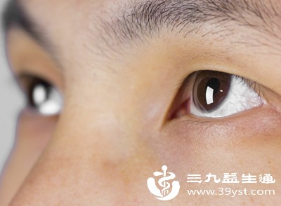 眼睛一高一低影响颜值 试试这些改善妙招让双眼更协调