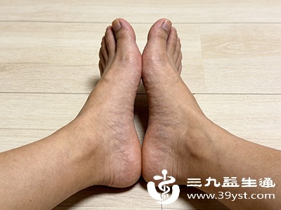 久坐男脚肿不只是疲劳可能藏着其他原因 这些信号要留意