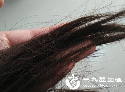头发易干枯、分叉，脱落量比平时增多
