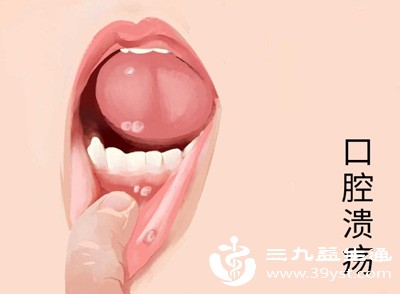 别忽视嘴巴苦可能是身体在报警