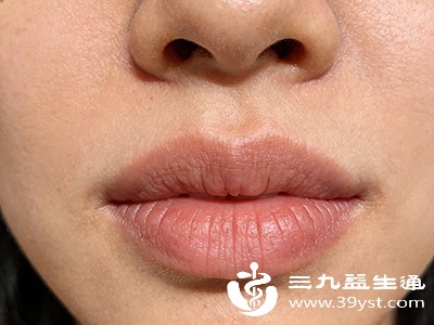 喝很多水嘴唇依旧干 不是缺水那么简单这些根源要排查