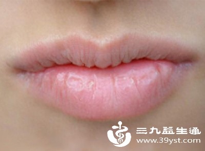 冬季暖气房内空气干燥，加速唇部水分流失