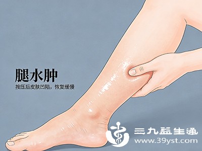 尤其下肢按压有明显凹陷且恢复慢