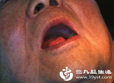 口腔有明显出血