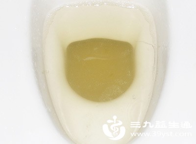 尿频的液体是尿液，有明显氨味（厕所味），颜色偏黄