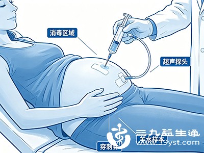穿刺部位多在腹部下方