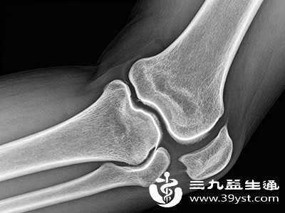 骨折影像学检查.jpg