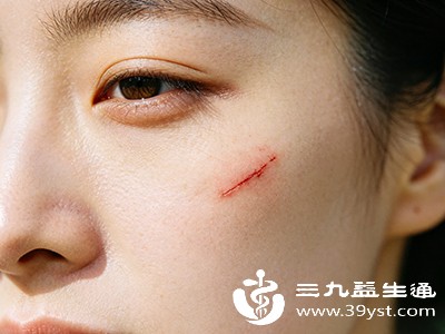 脸被指甲划伤怎么处理不会留疤 科学护理指南来了