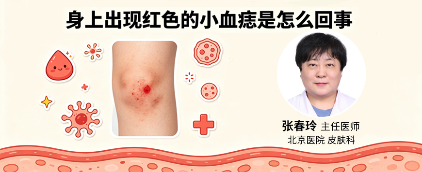 身上出现红色的小血痣是怎么回事