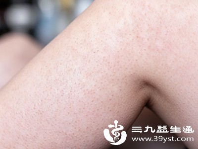 若腿上“鸡皮”突然加重，伴随明显瘙痒、红肿、疼痛
