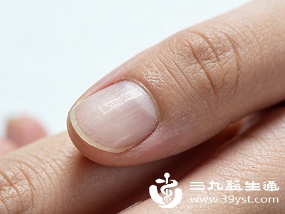 指甲修剪过短、嵌甲（指甲往肉里长），或指甲受到真菌感染，都可能引发无名指疼痛