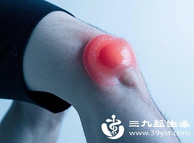 肌肉拉伤后疼痛升级 别慌！4大诱因及应对看这里