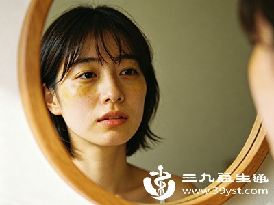 黄疸症状 黄疸症状