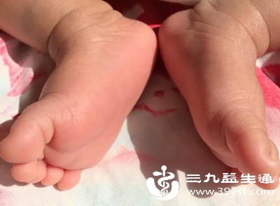 解锁宝宝手心出汗密码：生理性不用愁 病理性早发现早处理