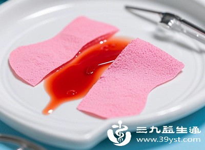 月经量明显多于平时，或出现经期延长、淋漓不尽等情况