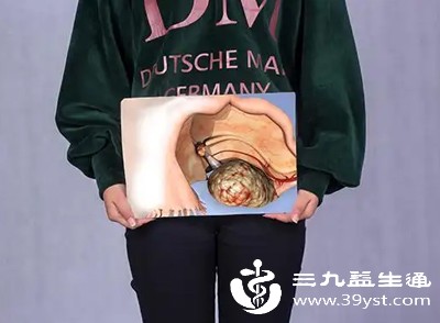 育龄期女性的卵巢在排卵期，卵泡周围会出现血流信号增多