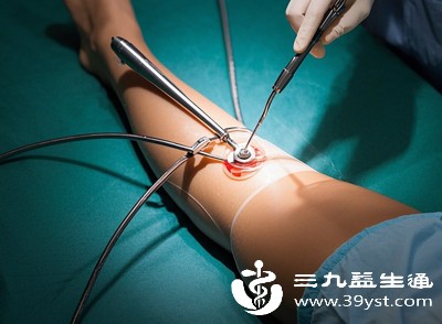 纠结吸脂肪伤不伤身 收藏这篇就够了 危害注意事项全覆盖