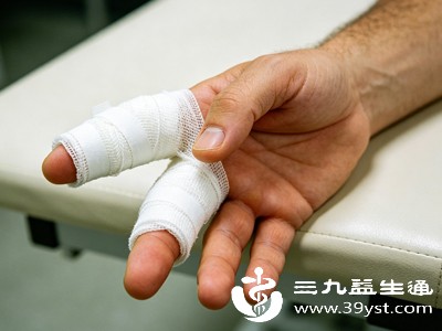 打石膏多久能拆 不同部位时间不一样 看完少走弯路