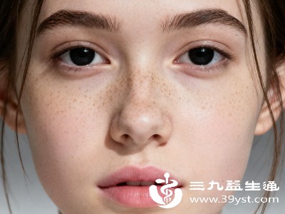 雀斑能彻底去掉吗 避开3个误区做好防晒 轻松拥有干净肌肤