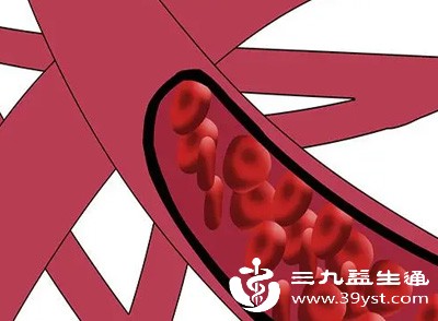很多时候,红细胞和血红蛋白偏高,是其他器官出现问题后的“连锁反应” 很多时候,红细胞和血红蛋白偏高,是其他器官出现问题后的“连锁反应”