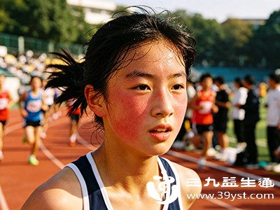 正常生理性脸红仅表现为面部发红，无其他不适