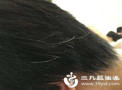 少数人天生头发就比较稀疏,尤其是头顶或发际线区域,影响美观,但自身后枕部毛发相对浓密,且没有其他影响毛囊存活的问题,也可以通过植发改善 少数人天生头发就比较稀疏,尤其是头顶或发际线区域,影响美观,但自身后枕部毛发相对浓密,且没有其他影响毛囊存活的问题,也可以通过植发改善