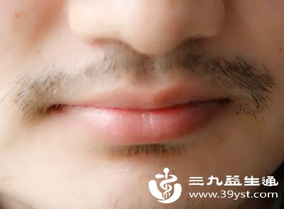 想让胡须永久消失 激光vs电解脱毛哪种方法更适合你