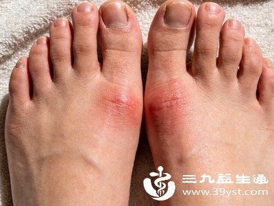 一些全身性的炎症性疾病,可能会累及足部关节,导致脚背疼痛,通常还会伴随其他关节的不适 一些全身性的炎症性疾病,可能会累及足部关节,导致脚背疼痛,通常还会伴随其他关节的不适
