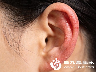 正常瘙痒大多出现在打耳洞后3-14天,也就是伤口结痂、新生组织生长阶段,会随愈合逐渐消失 正常瘙痒大多出现在打耳洞后3-14天,也就是伤口结痂、新生组织生长阶段,会随愈合逐渐消失