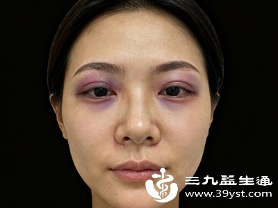 对于大多数轻微磕碰造成的淤青，面积不大、颜色较浅，身体会自行启动修复机制，通常7-14天就能完全消除