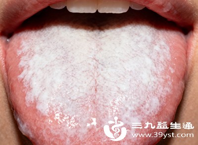 如果舌苔发白的同时,还伴随口腔黏膜发红、轻微疼痛,可能是轻微的口腔炎症,多由细菌或病毒感染引起,注意口腔卫生后通常能慢慢好转 如果舌苔发白的同时,还伴随口腔黏膜发红、轻微疼痛,可能是轻微的口腔炎症,多由细菌或病毒感染引起,注意口腔卫生后通常能慢慢好转