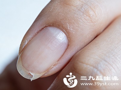 外伤或长期刺激:指甲结构受损 外伤或长期刺激:指甲结构受损
