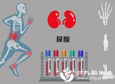 尿酸是嘌呤代谢的产物,主要通过肾脏排泄 尿酸是嘌呤代谢的产物,主要通过肾脏排泄