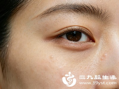 别再被误导了 散瞳不是“降度数” 是还原你眼睛的真实状态