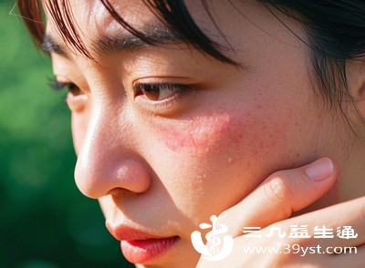 若涂抹后出现刺痛、发红，立即用温水洗净，暂停使用1-2天，待肌肤恢复后再继续
