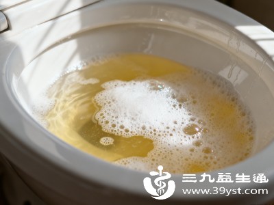 睡眠质量好、一夜无起夜的人,尿液浓缩得更明显,颜色可能会更深一些,这都属于正常情况,无需紧张 睡眠质量好、一夜无起夜的人,尿液浓缩得更明显,颜色可能会更深一些,这都属于正常情况,无需紧张