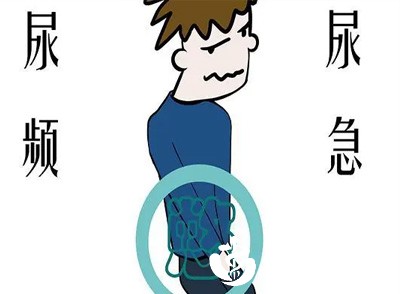 男性伴随尿频、尿急等症状