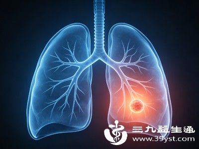 肺部结节5mm要手术吗 答案来了 无需过度治疗定期随访就安心