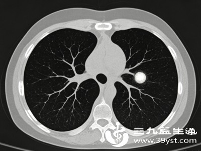 很多人查出结节后,会急于“消除”结节,盲目服用各种保健品、偏方,或是主动要求手术切除,这些都是错误的做法 很多人查出结节后,会急于“消除”结节,盲目服用各种保健品、偏方,或是主动要求手术切除,这些都是错误的做法