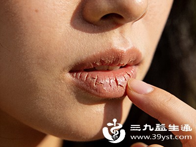 注意！晨起口干口苦不是小问题 可能和这些习惯或健康问题有关 快自查