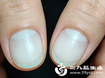 指甲长期接触刺激性物质或受到外力损伤，也可能产生横纹