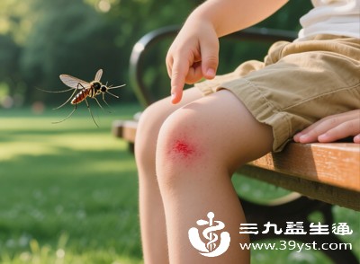 蚊虫叮咬初期的红肿、轻微烫伤后的红肿，也适合用冷敷缓解