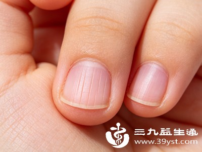中医认为“肝主筋,其华在爪”,爪即指甲,指甲的状态直接反映肝脏气血充足度 中医认为“肝主筋,其华在爪”,爪即指甲,指甲的状态直接反映肝脏气血充足度
