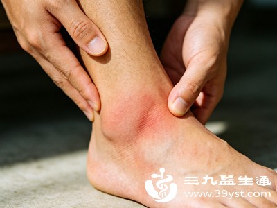 多数人的崴脚后遗症，都是错误养护导致的