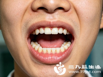 说话、微笑时有意识地提醒自己,让嘴角向中间发力,避免偏向一侧,坚持1-2个月,就能明显感受到变化 说话、微笑时有意识地提醒自己,让嘴角向中间发力,避免偏向一侧,坚持1-2个月,就能明显感受到变化